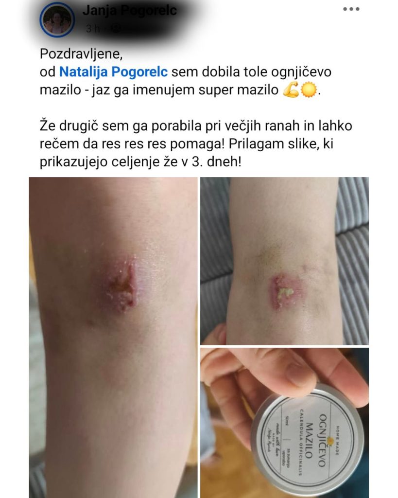 ognjič